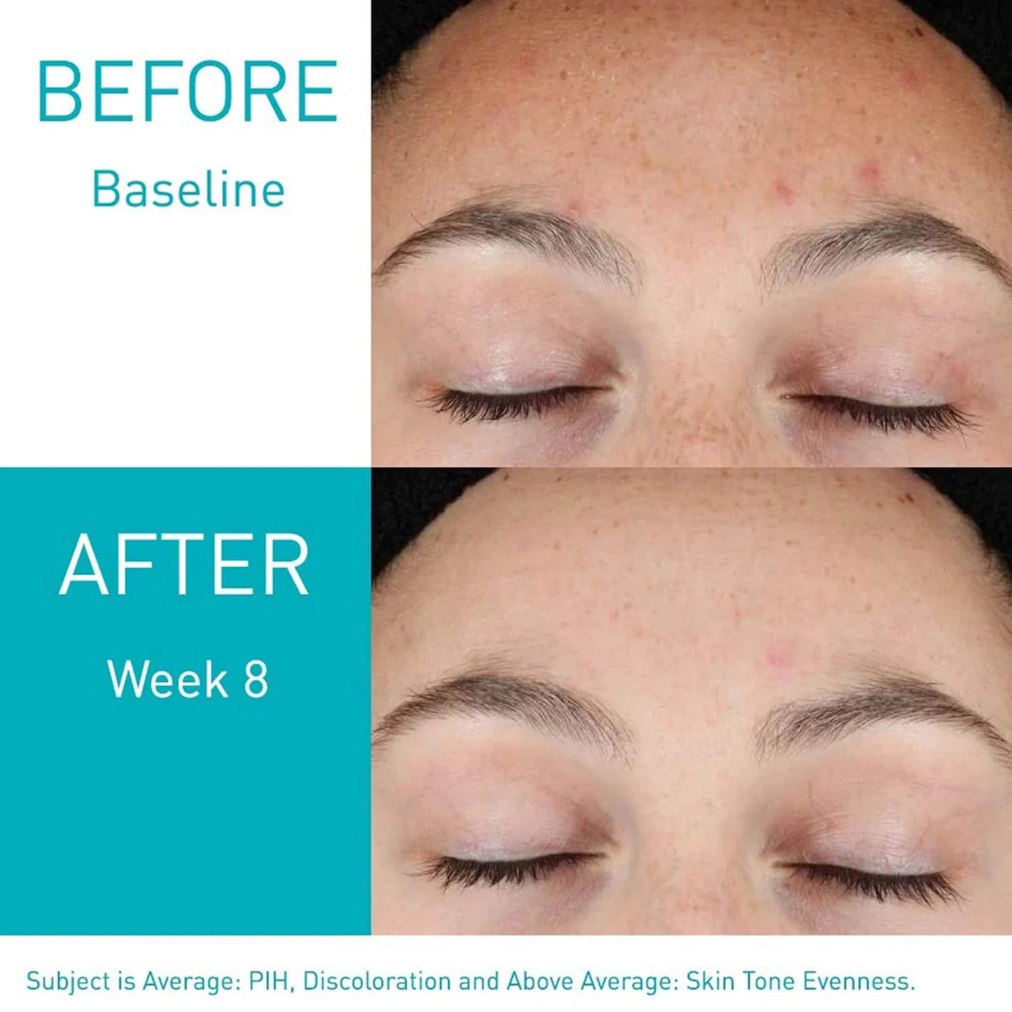 Resurfacing Retinol Serum